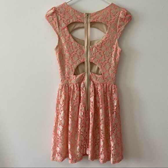 BEAUTIFUL LACE DRESS - Picture 2 of 11